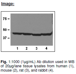 Anti beta Actin, Monoclonal antibody
