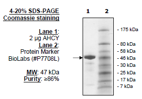 AHCY, S. solfataricus, His-tag