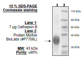 Image of Cathepsin B